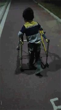 spr手术治疗痉挛性截瘫,spr术效果