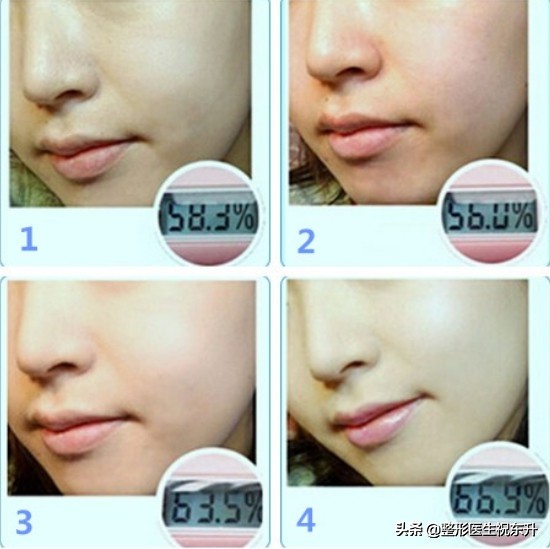 水光针的术前注意事项,打水光针之前要问什么问题