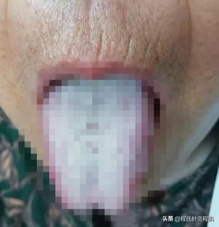 程凯养生说满脸都是斑,程凯养生说肝