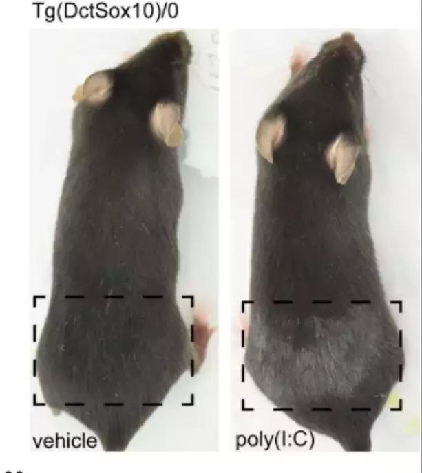 后天少白头原因,少白头和内分泌有关吗