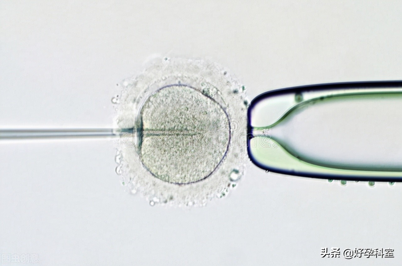 人工授精为什么能够提高成功率,人工授精成功秘诀