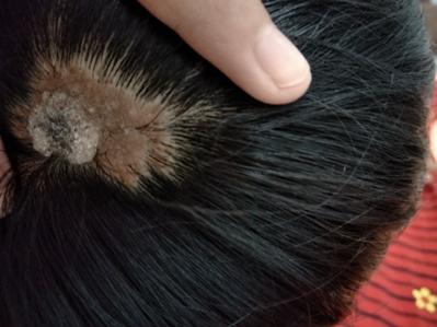 痣的位置真的有讲究吗,痣相说法为什么不一样