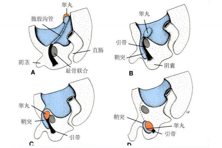 腹股沟中间那块肉是什么情况,腹股沟处在哪