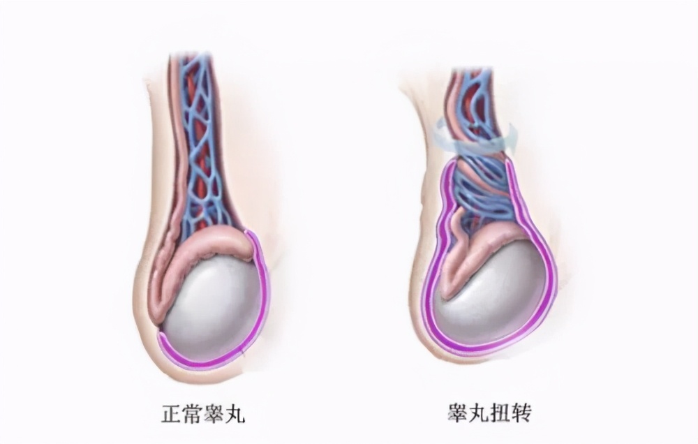 男性健康日应该准备什么,全国男性健康日