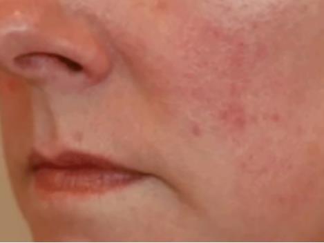 干皮保姆级护肤指南,保姆肌护肤知识