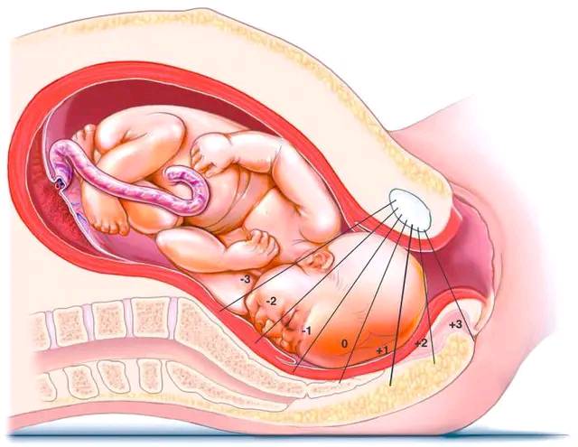 女人顺产除了痛还有什么症状,女人顺产和剖腹产都怎样的疼痛