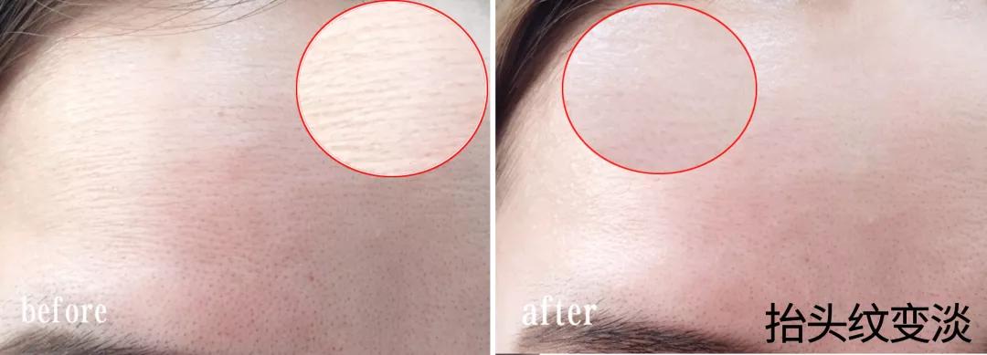 我的21天美容之路,我的养肤秘籍