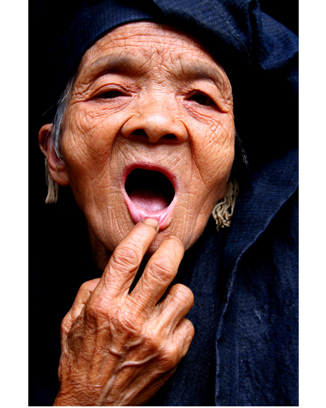 给老子的老师瞧瞧牙病