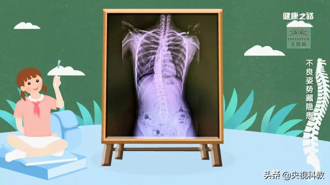 小孩驼背怎么矫正过来,孩子驼背可以按回去吗