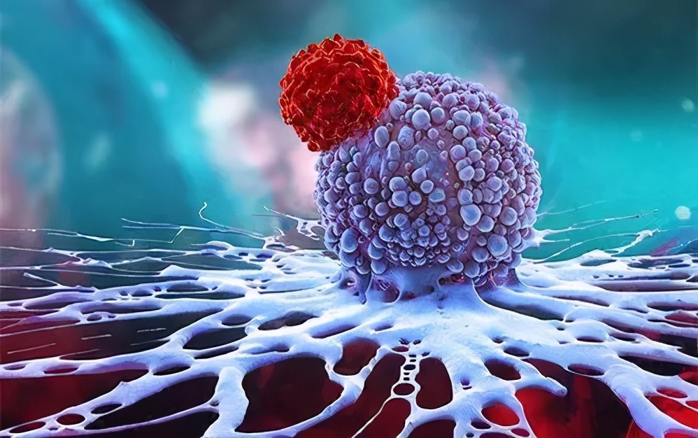 宫颈癌复发等死吗,宫颈癌复发适合做介入吗