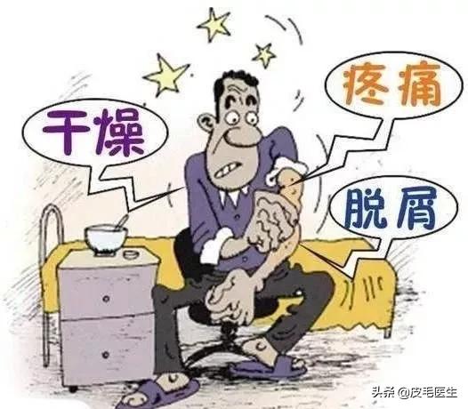 浑身瘙痒有很多皮屑,浑身瘙痒起鸡皮疙瘩怎么回事
