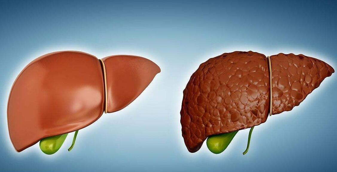 脾脏42mm算脾大吗是肝硬化吗,脾气大不代表不好