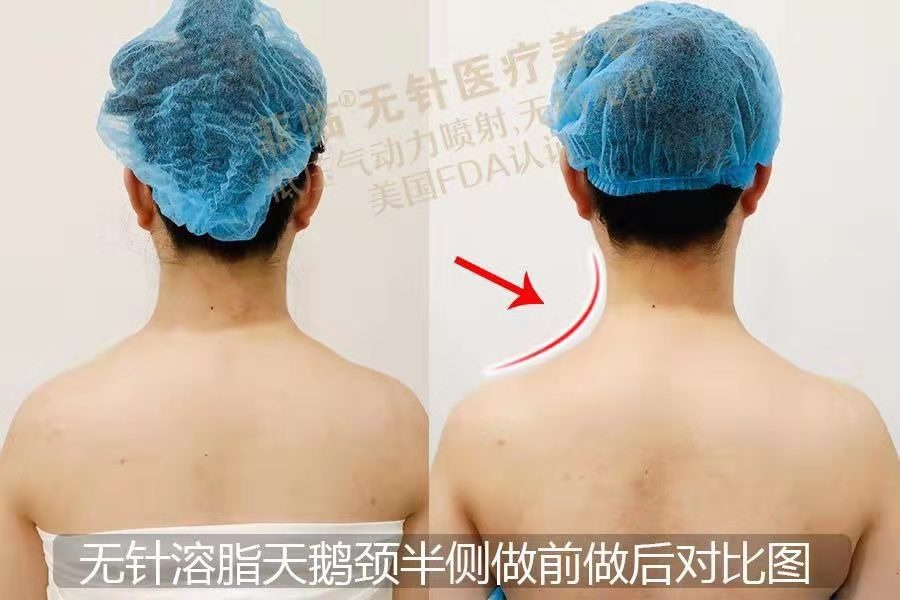 逆天侧颜女,逆天绝世容颜