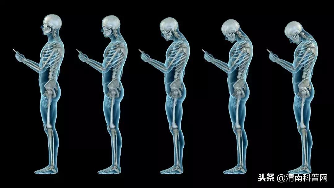 看看吧！这个小动作有可能导致瘫痪！