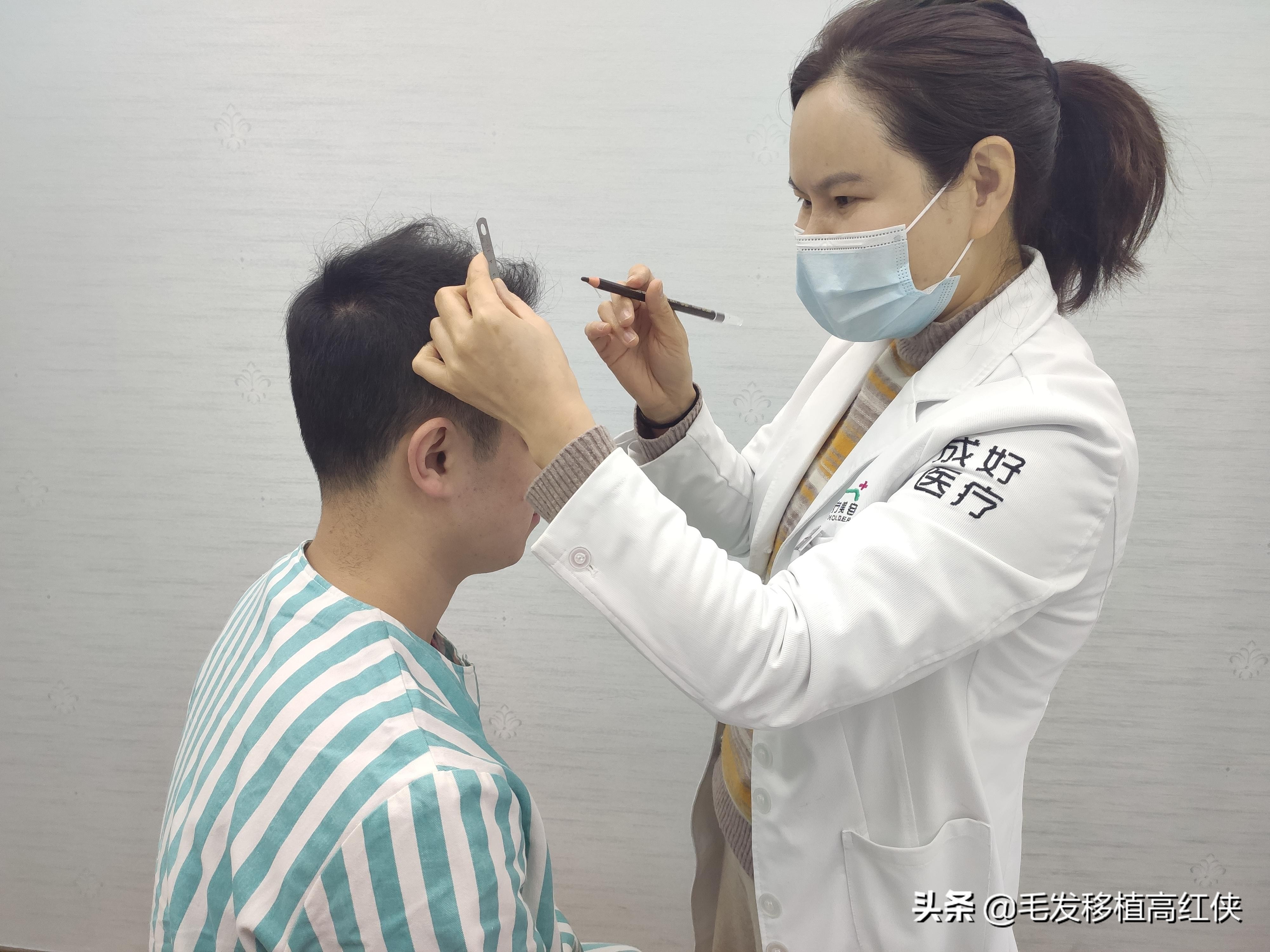 脱发治疗要趁早！植发更要趁早