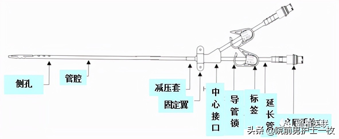 深静脉置管锁骨下静脉穿刺部位,深静脉穿刺置管拔出需要注意什么