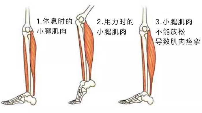 运动时总是抽筋怎么办,运动时为什么会抽筋