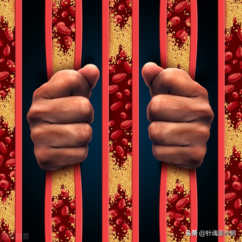 脑血管堵塞90%能保守治疗么,脑血管堵塞95%可以保守治疗吗