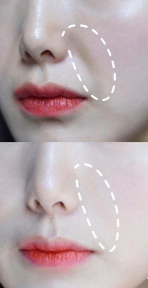 脸部什么纹路最显老,脸上显老的两条线