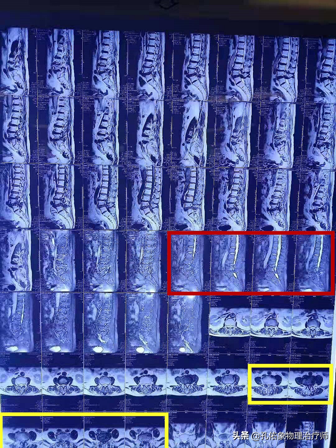 中老年人养生延年益寿小窍门,老年人怎样养生才健康长寿