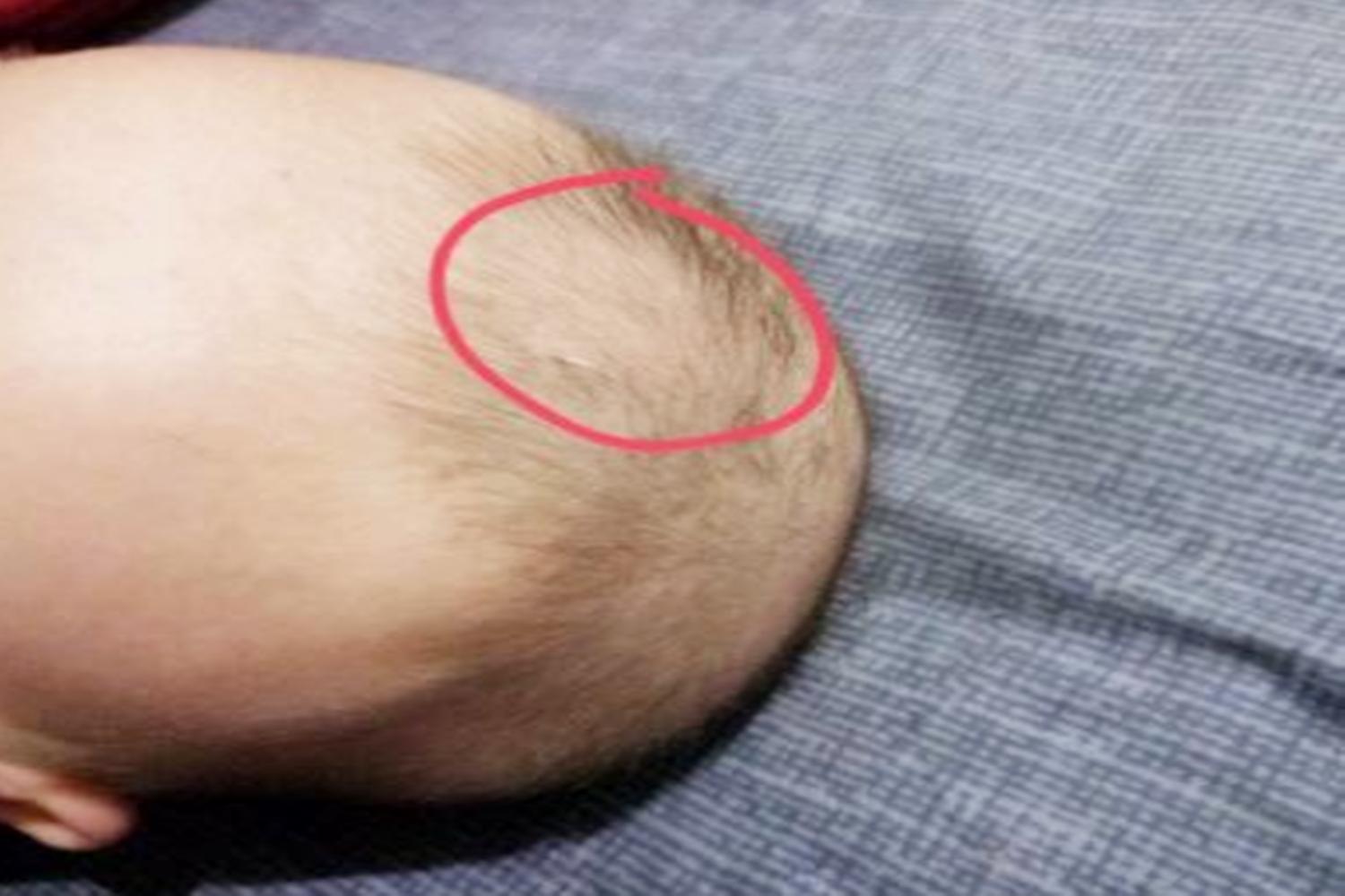 宝宝头顶上的污垢用香油可以吗,婴儿头顶污垢洗了又长怎么回事