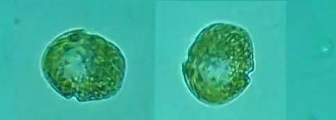 水产养殖藻类老化是怎样的,水产养殖显微镜下各种藻类