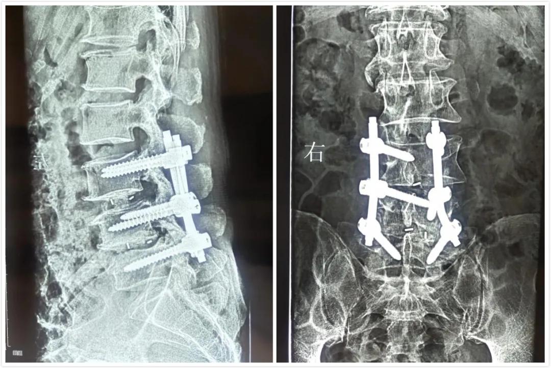 解除颈椎腰椎烦恼,解除病痛与消除病痛