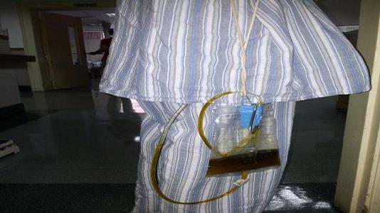 癌症眼部皮肤变色,皮肤黄眼睛黄是什么癌