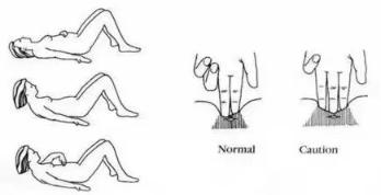 产后恢复必做的六件事,产后恢复必备100个知识