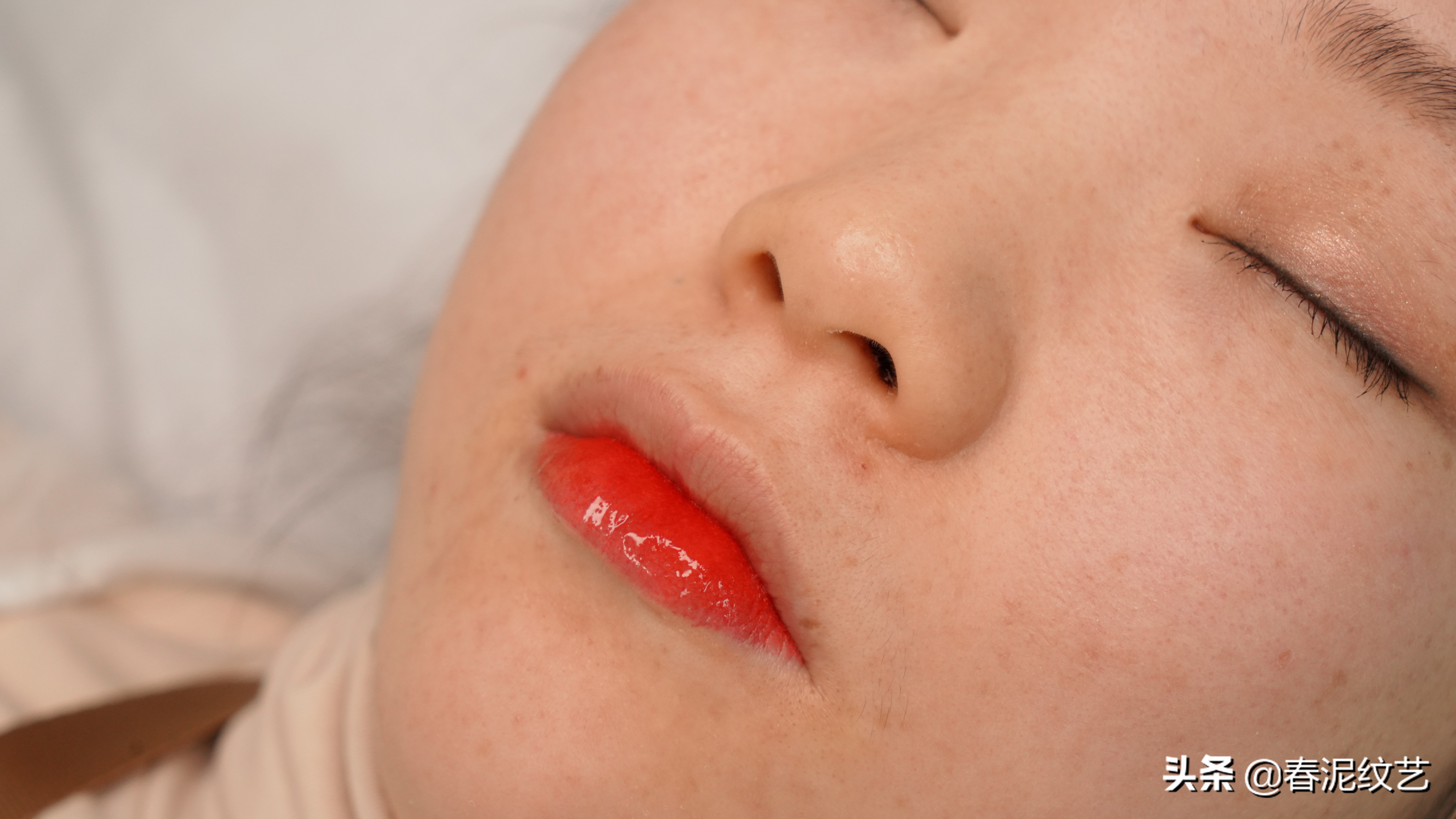 顾客纹唇后不忌口,起泡了怎么办?