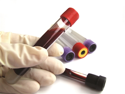 糖化血红蛋白长期6.5严重吗,糖化血红蛋白6.6严重吗怎么治疗