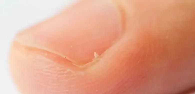 宝宝指甲月牙少有白点怎么回事,宝宝指甲出现空甲现象怎么办