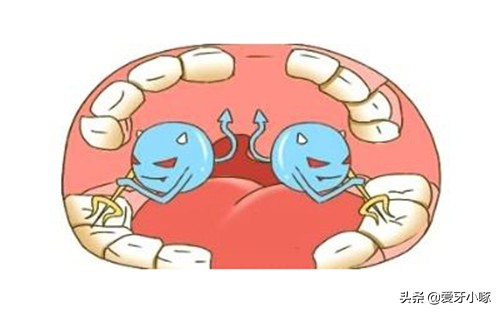 小孩儿蛀牙怎么办？妙招教给你