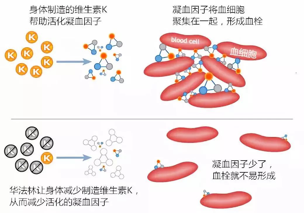 华法林,你用对了吗?