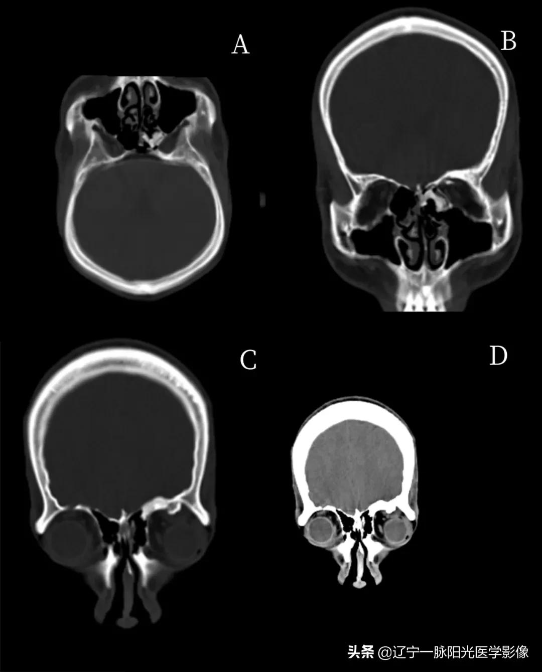 眼部疾病诊断有哪些,眼部病变有哪些症状