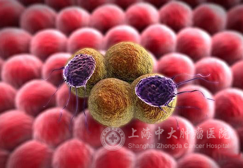 乳腺结节癌前病变会发展成癌症吗,查出癌