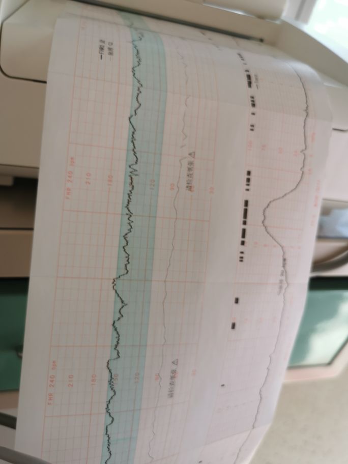 除夕夜在医院度过，鼠年到牛年，我走过的保胎之路