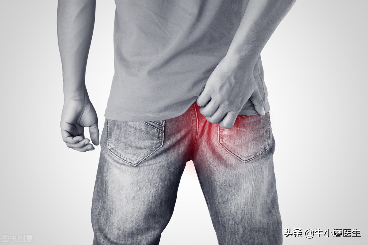 大便之后肛门瘙痒洗干净会好吗,大便后肛门瘙痒怎么办