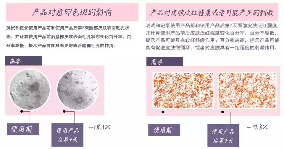 去皱美白精华国货,100元国货美白精华推荐