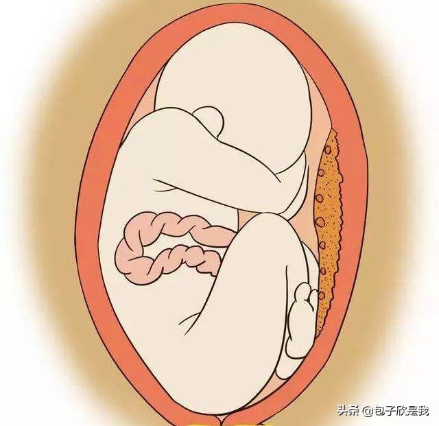 o型腿宝宝x型腿怎么判断,怎么判断孩子的腿是不是o型腿