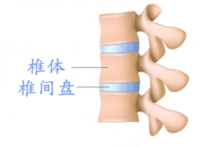 腰椎间盘膨出20天了还算急性期吗,腰椎间盘膨出到医院挂什么科诊断