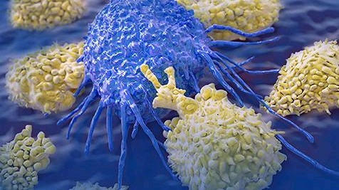 肿瘤免疫表达是什么意思,肿瘤免疫指的是什么