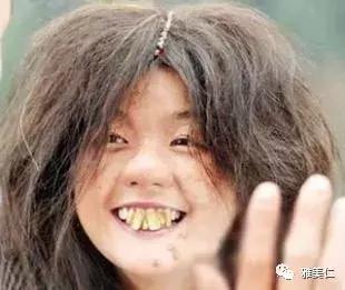 笑起来好不好看由什么决定,笑的好不好看不重要开心最重要