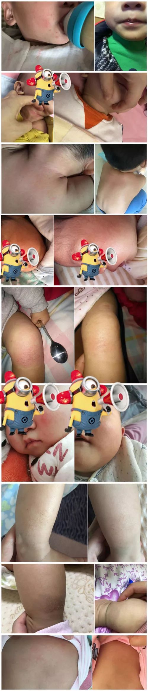 测评湿疹膏,婴儿湿疹膏测评