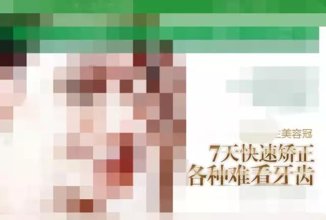 美容冠是指的什么,美容冠到底是什么