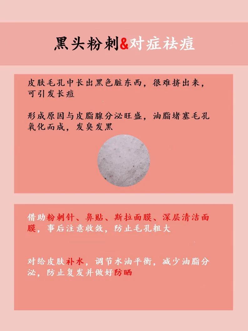各种类型痘痘,可以针清的痘痘类型
