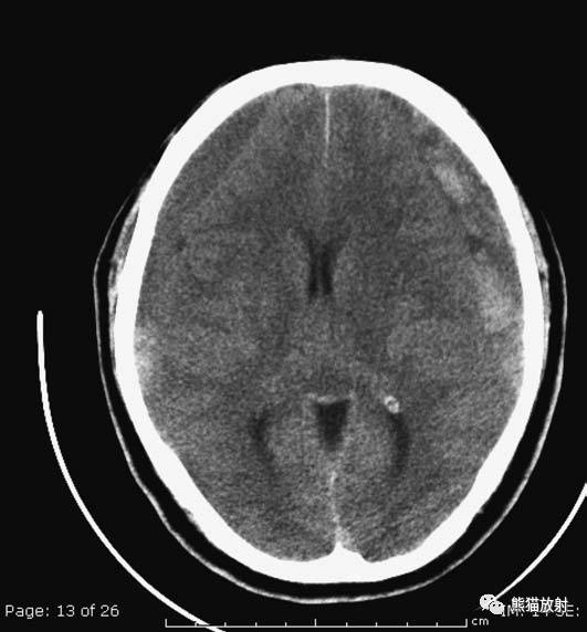 值夜班需要注意什么身体健康,值夜班的十大危害