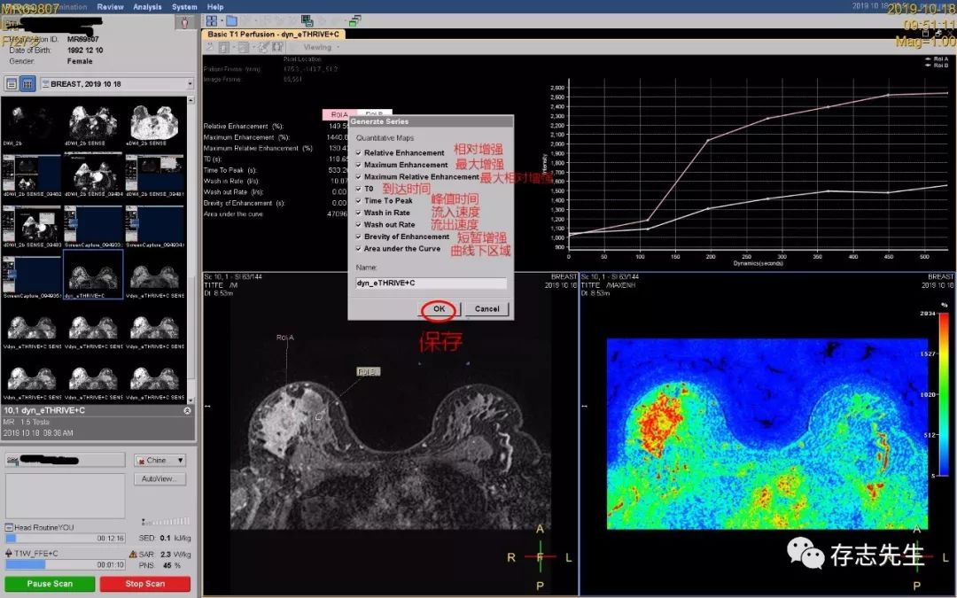 乳腺磁共振亲身经历,磁共振乳腺动态增强扫描全过程