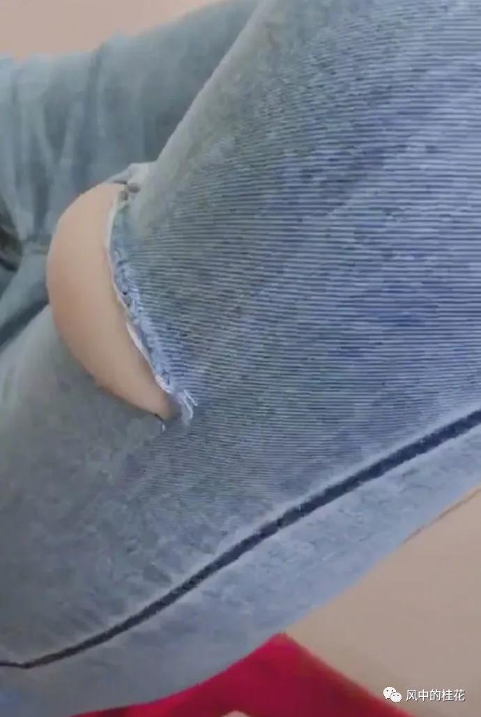 溜冰摔了膝盖关节处肿了,溜冰摔倒了膝盖不能弯曲