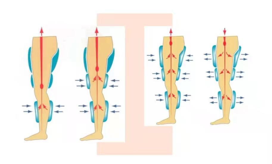 体外反搏治疗多长时间有效果,体外反搏的几种方法